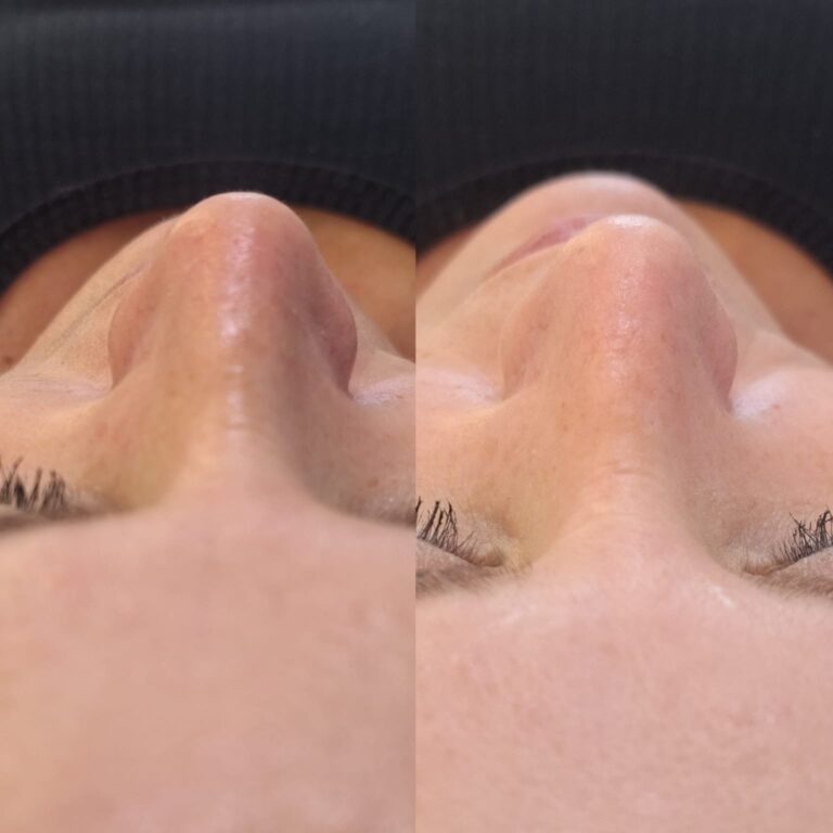 Estética facial e corporal · Salão Ernane Victor — salão de beleza em São Domingos, Poços de Caldas - MG