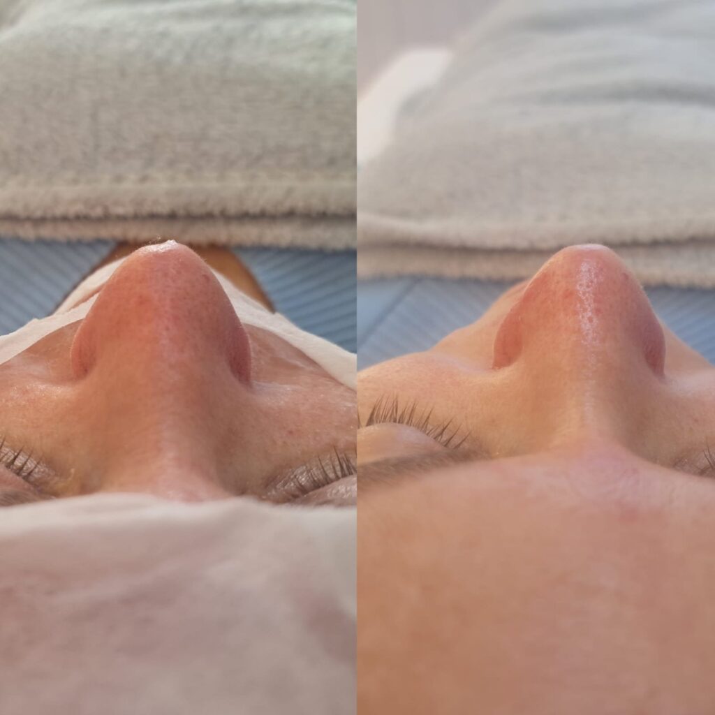 Estética facial e corporal – Salão Ernane Victor, Poços de Caldas - MG – foto 7