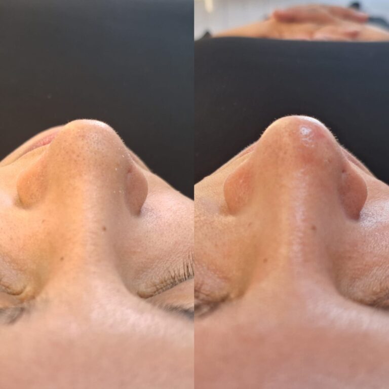 Estética facial e corporal · Salão Ernane Victor — salão de beleza em São Domingos, Poços de Caldas - MG