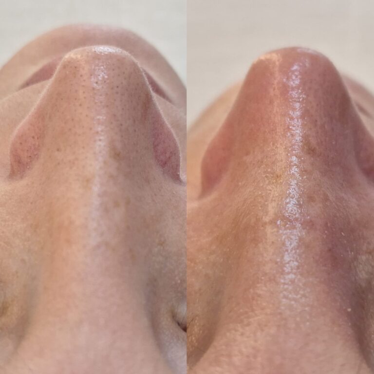 Estética facial e corporal · Salão Ernane Victor — salão de beleza em São Domingos, Poços de Caldas - MG