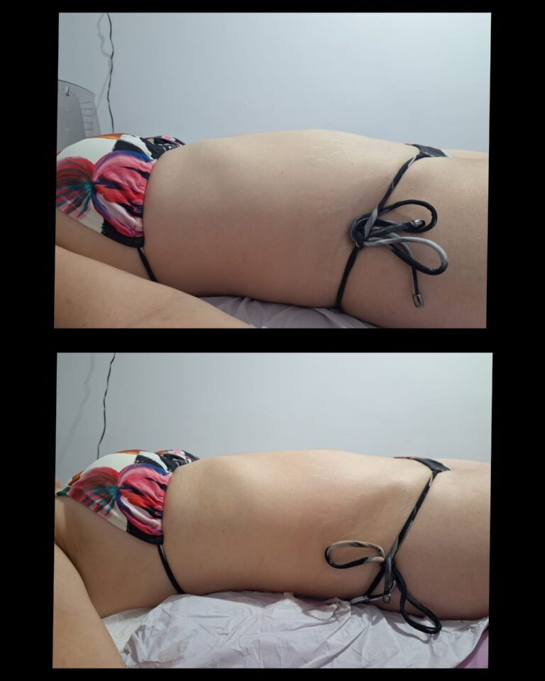 Estética facial e corporal · Salão Ernane Victor — salão de beleza em São Domingos, Poços de Caldas - MG