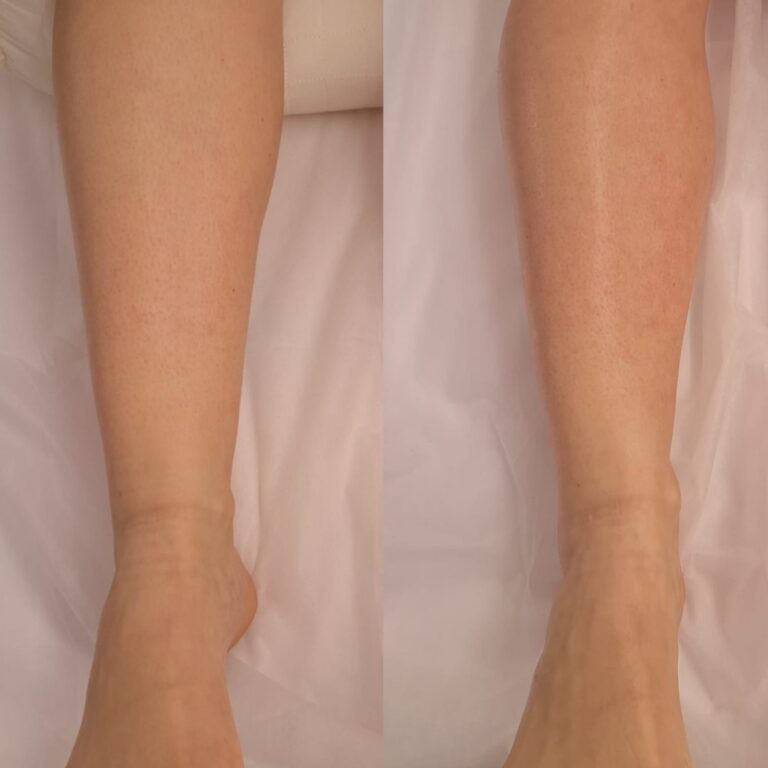 Estética facial e corporal · Salão Ernane Victor — salão de beleza em São Domingos, Poços de Caldas - MG