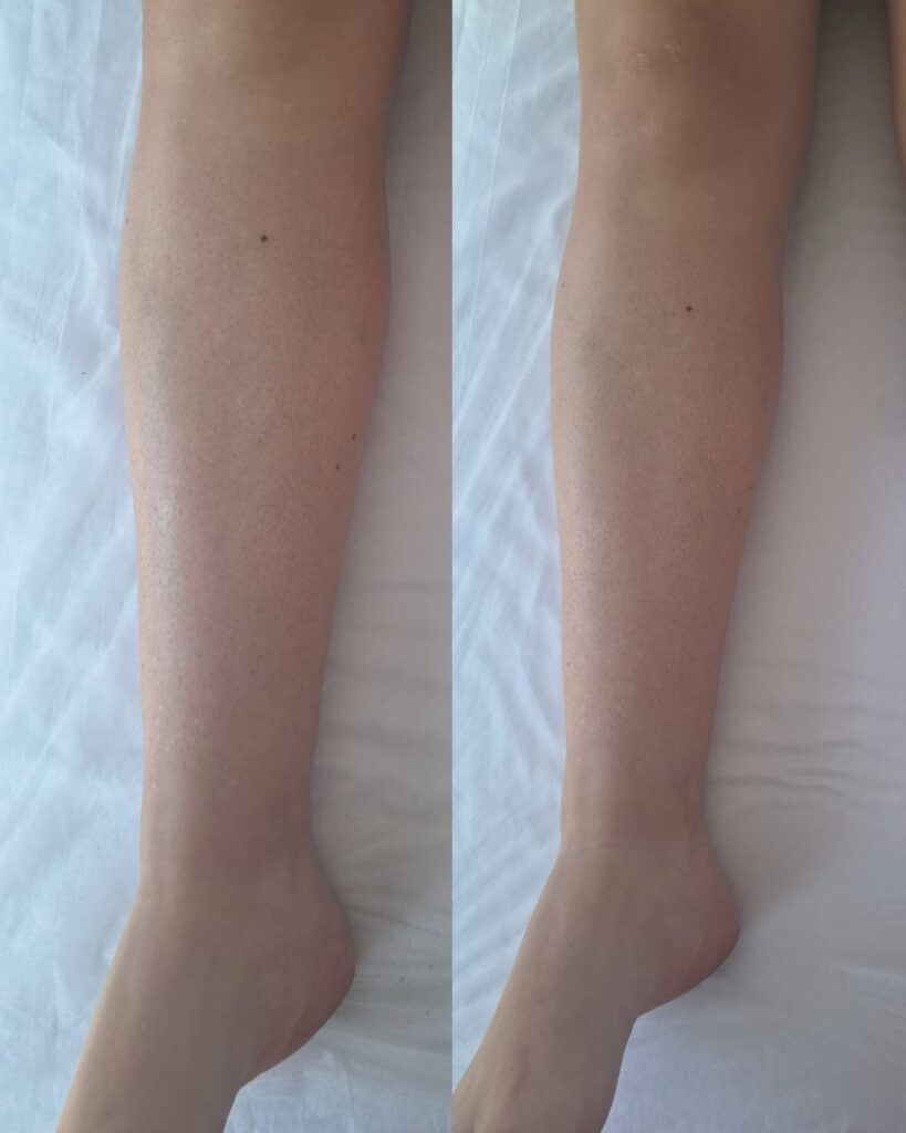 Estética facial e corporal – Salão Ernane Victor, Poços de Caldas - MG – foto 5