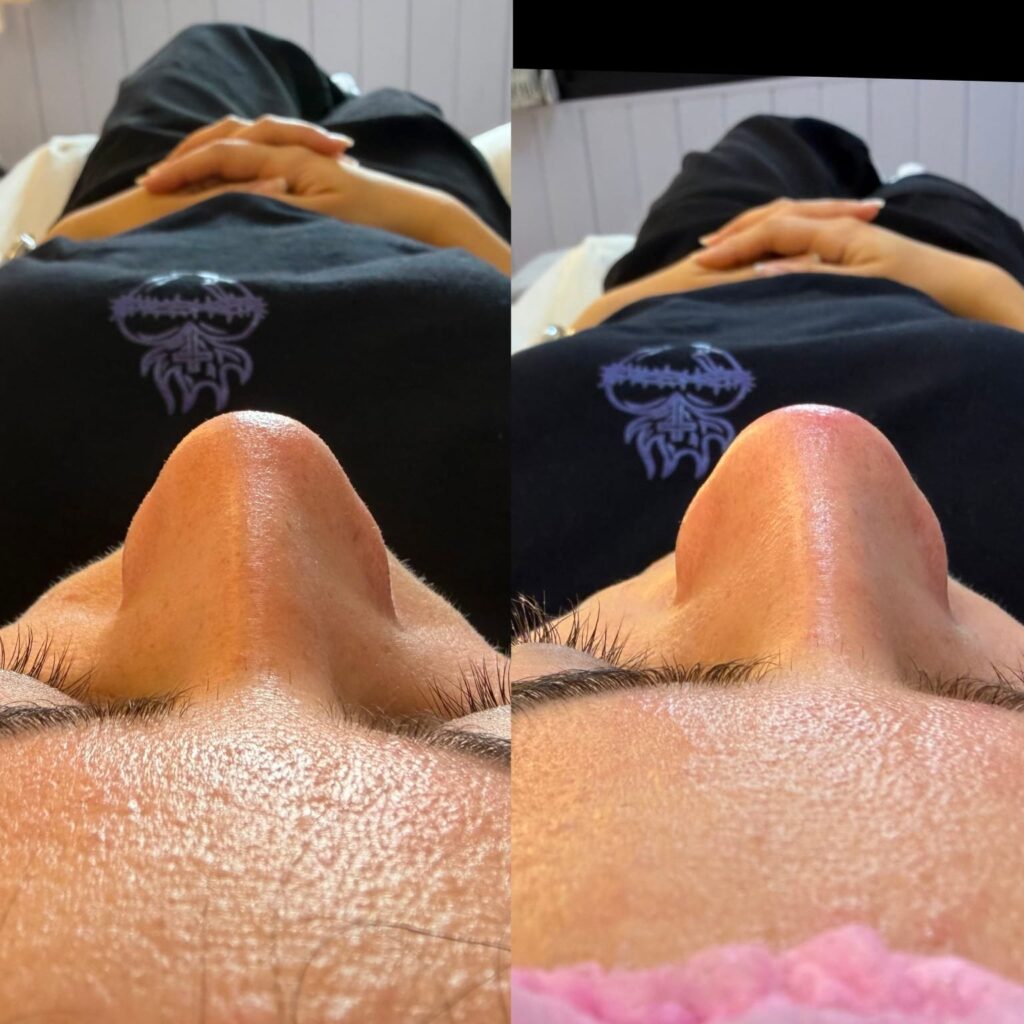 Estética facial e corporal – Salão Ernane Victor, Poços de Caldas - MG – foto 4