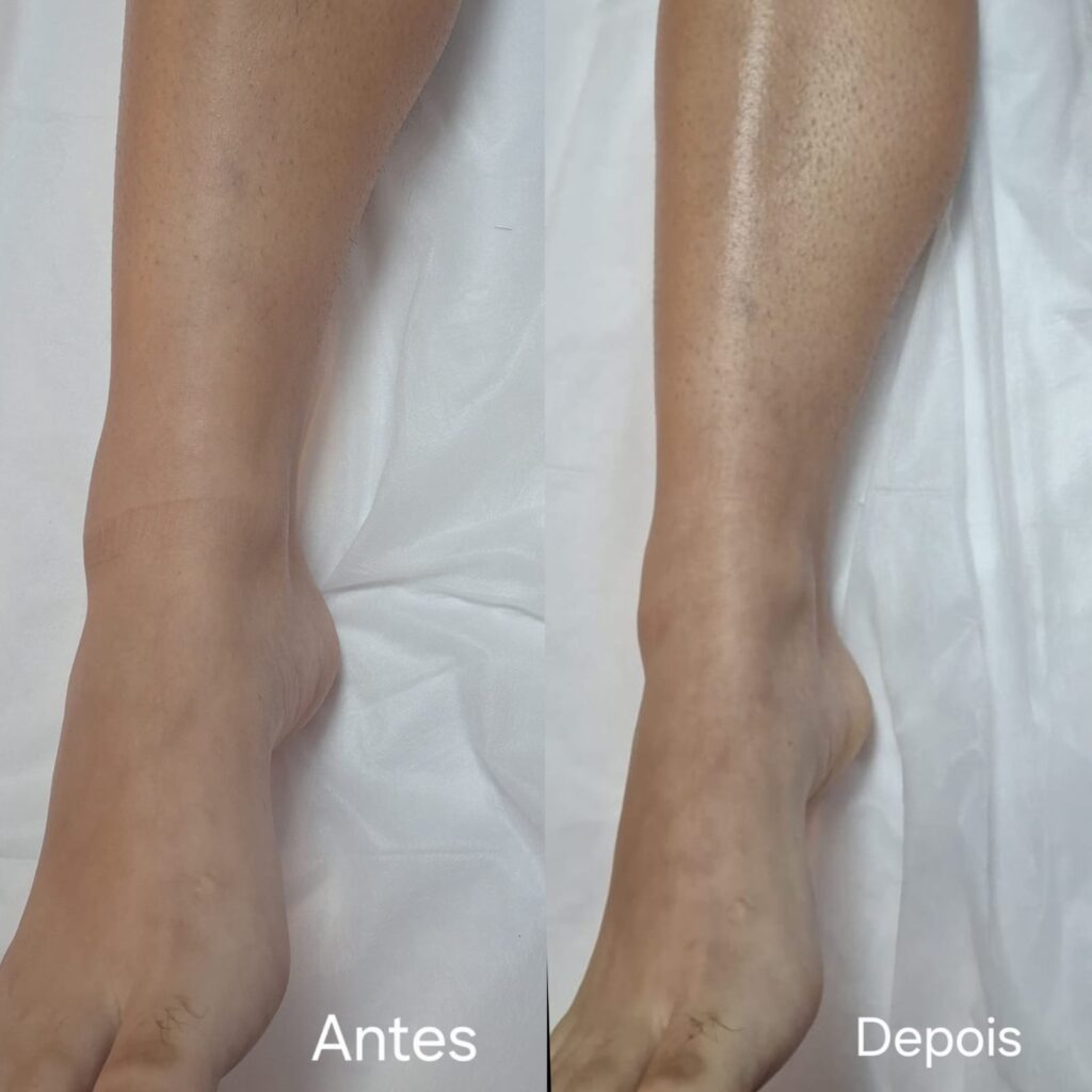 Estética facial e corporal – Salão Ernane Victor, Poços de Caldas - MG – foto 1
