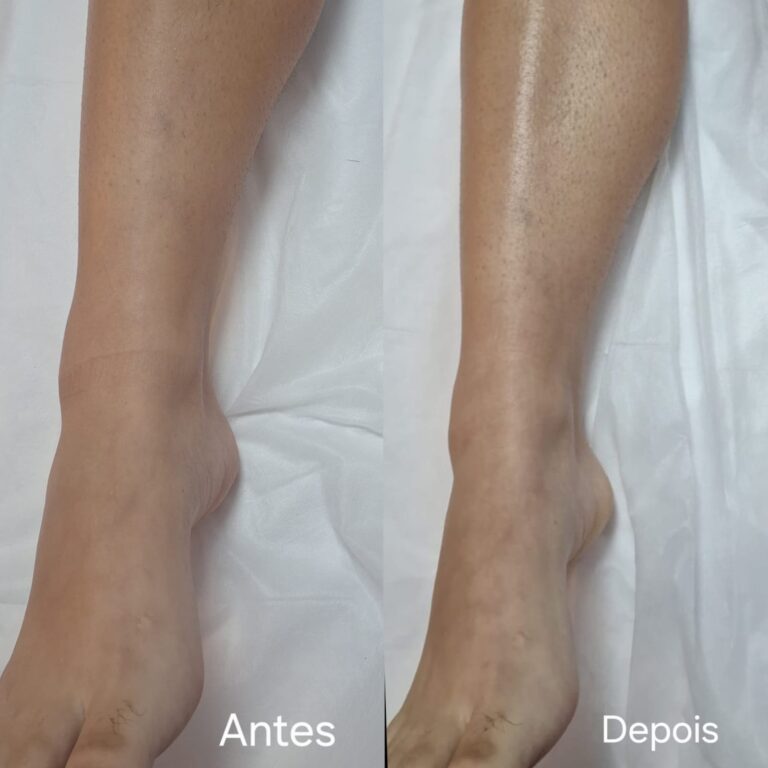 Estética facial e corporal · Salão Ernane Victor — salão de beleza em São Domingos, Poços de Caldas - MG